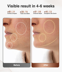 High-Performance 3D LED Beauty Mask – 4 Light Modes, 328 LEDs, Wireless Operation, Adjustable Timer, Lightweight & Flexible Fit – Reveal Radiant Skin (Brown)